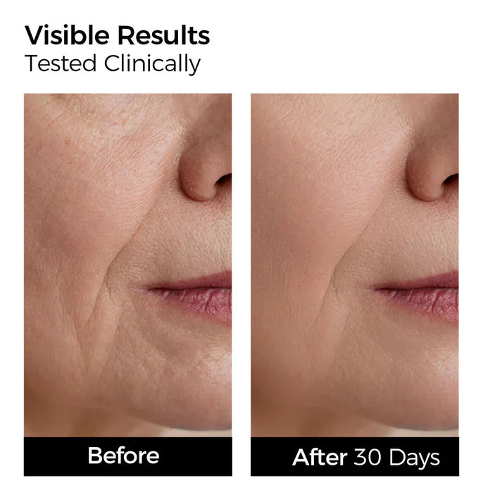 3% 4D Hyaluronic Acid Serum with Multi-Layer Hydration for Dry Skin